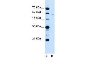 MGC39633 antibody used at 1. (MGC39633 (N-Term) 抗体)