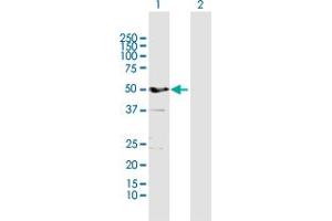 Western Blot analysis of ALDH3A1 expression in transfected 293T cell line by ALDH3A1 MaxPab polyclonal antibody. (ALDH3A1 抗体  (AA 1-453))