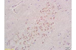 Immunohistochemistry (Paraffin-embedded Sections) (IHC (p)) image for anti-Integrin beta 1 (ITGB1) (AA 25-100) antibody (ABIN669216)