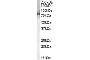 Western Blotting (WB) image for anti-Choline O-Acetyltransferase (CHAT) (AA 629-642) antibody (ABIN299161) (Choline Acetyltransferase 抗体  (AA 629-642))