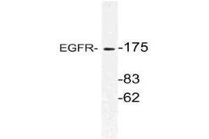 Western blot (WB) analysis of EGFR antibody in extracts from HeLa cells. (EGFR 抗体)