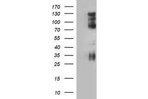 Image no. 1 for anti-CD44 (CD44) antibody (ABIN1497321) (CD44 抗体)