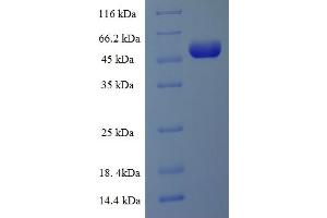 SDS-PAGE (SDS) image for Solute Carrier Family 27 (Fatty Acid Transporter), Member 2 (SLC27A2) (AA 283-620), (Cytoplasmic Domain), (Cytosolic) protein (His-SUMO Tag) (ABIN5710372) (SLC27A2 Protein (AA 283-620, Cytoplasmic Domain, Cytosolic) (His-SUMO Tag))