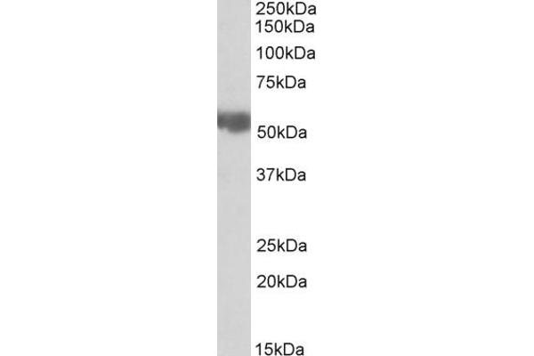 ALDH3A2 抗体  (Internal Region)