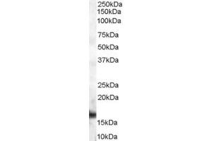 Western Blotting (WB) image for anti-Dachshund 2 (DACH2) (C-Term) antibody (ABIN2156671) (DACH2 抗体  (C-Term))