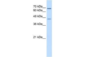 ALDH3A2 antibody used at 0. (ALDH3A2 抗体  (C-Term))