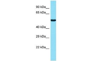 Host: Rabbit Target Name: ANKRD34B Sample Type: 721_B Whole Cell lysates Antibody Dilution: 1. (ANKRD34B 抗体  (N-Term))