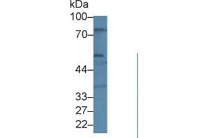 Western blot analysis of Human U87-MG cell lysate, using Human BEST1 Antibody (1 µg/ml) and HRP-conjugated Goat Anti-Rabbit antibody ( (Bestrophin 1 抗体  (AA 292-585))