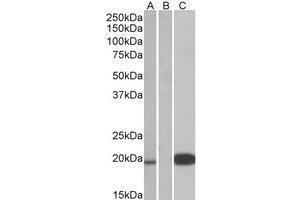 HEK293 lysate (10ug protein in RIPA buffer) over expressing Human UCN3 with DYKDDDDK tag probed with AP31556PU-N (1 µg/ml) in Lane A and probed with anti-DYKDDDDK Tag (1/3000) in lane C. (UCN3 抗体  (Internal Region))