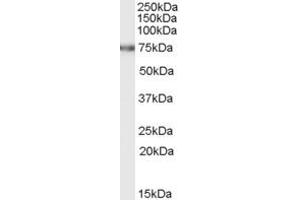 Western Blotting (WB) image for anti-Fem-1 Homolog C (FEM1C) (C-Term) antibody (ABIN2465691) (FEM1C 抗体  (C-Term))