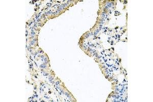 Immunohistochemistry of paraffin-embedded mouse lung using CHCHD3 antibody. (CHCHD3 抗体  (AA 1-227))