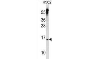 Western Blotting (WB) image for anti-MAX Dimerization Protein 3 (MXD3) antibody (ABIN2998538) (MXD3 抗体)