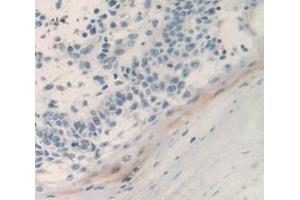 IHC-P analysis of Human Tissue, with DAB staining. (PSCA 抗体  (AA 22-95))