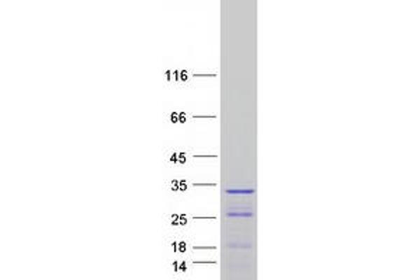 PPP1R12B Protein (Transcript Variant 4) (Myc-DYKDDDDK Tag)