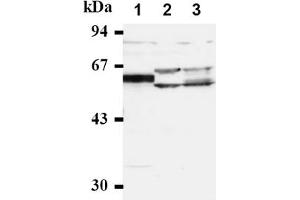 Western Blotting (WB) image for anti-Cell Division Cycle 25 Homolog A (S. Pombe) (CDC25A) antibody (ABIN487483) (CDC25A 抗体)