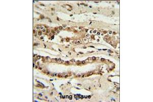 FOXP1 Antibody IHC analysis in formalin fixed and paraffin embedded lung tissue followed by peroxidase conjugation of the secondary antibody and DAB staining. (FOXP1 抗体  (C-Term))