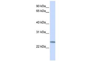 C12ORF49 antibody used at 1 ug/ml to detect target protein. (C12orf49 抗体  (C-Term))