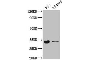 Western Blot Positive WB detected in: PC-3 whole cell lysate, Mouse kidney tissue All lanes: POLR2C antibody at 3. (POLR2C 抗体  (AA 2-275))