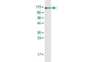 Western Blot detection against Immunogen (102. (CD44 抗体  (AA 1-699))