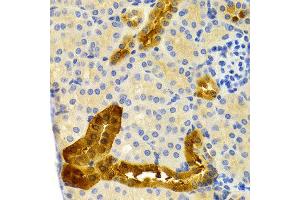 Immunohistochemistry (IHC) image for anti-Parvalbumin (PVALB) antibody (ABIN3016701) (PVALB 抗体)