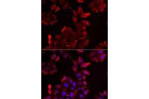 Immunofluorescence analysis of U2OS cells using PDLIM1 antibody. (PDLIM1 抗体)