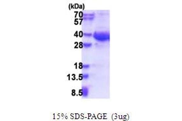 EXOSC8 Protein (AA 1-276) (His tag)