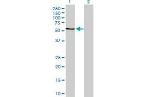 Western Blot analysis of RPS6KB2 expression in transfected 293T cell line by RPS6KB2 MaxPab polyclonal antibody. (RPS6KB2 抗体  (AA 1-482))