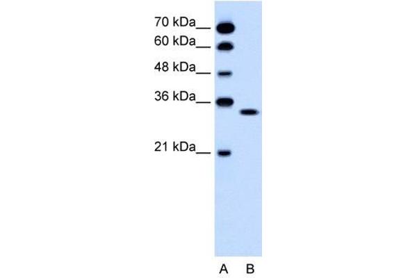 OR5T2 抗体  (C-Term)