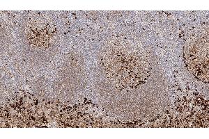 Human tonsil: immunohistochemical staining for Immunoglobulin G. (IgG 抗体)