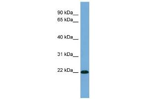 WB Suggested Anti-FGF13 Antibody Titration: 0. (FGF13 抗体  (Middle Region))