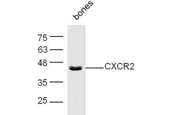CXCR2 抗体  (AA 316-360)