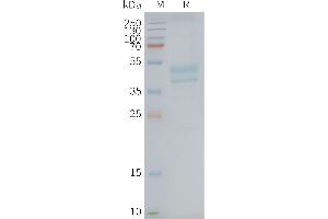Human C5AR1-Nanodisc, Flag Tag on SDS-PAGE (C5AR1 蛋白)