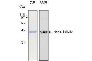 10% SDS-PAGE stained with Coomassie Blue (CB), immunobloting with anti-6xHis (WB) serum and peptide fingerprinting by MALDI-TOF-TOF mass spectrometry (Emilin1 Protein (AA 676-1016) (His tag))