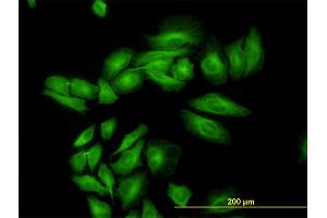 Immunofluorescence (IF) image for anti-Enolase 3 (Beta, Muscle) (ENO3) (AA 228-277) antibody (ABIN560744)