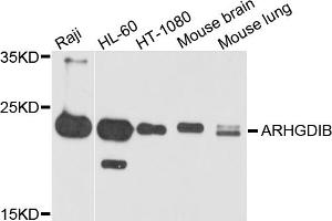 Western blot analysis of extracts of various cell lines, using ARHGDIB antibody. (ARHGDIB 抗体)