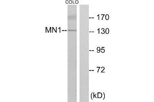 Western Blotting (WB) image for anti-MN1 proto-oncogene (MN1) (Internal Region) antibody (ABIN1849560) (Meningioma 1 抗体  (Internal Region))