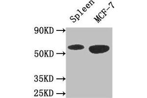 Western Blot Positive WB detected in: Mouse spleen tissue, MCF-7 whole cell lysate All lanes: AMPK1 antibody at 3 μg/mL Secondary Goat polyclonal to rabbit IgG at 1/50000 dilution Predicted band size: 65, 66 kDa Observed band size: 65 kDa (PRKAA1 抗体  (Catalytic Subunit alpha))