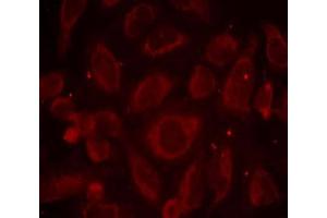 Immunofluorescence staining of methanol-fixed HeLa cells using NF-κB p65 (phospho-Ser468) antibody (E011013, Red) (NF-kB p65 抗体  (pSer468))