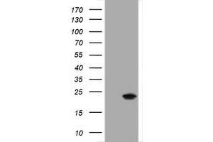 Western Blotting (WB) image for anti-Crystallin, alpha A (CRYAA) antibody (ABIN2715977) (CRYAA 抗体)