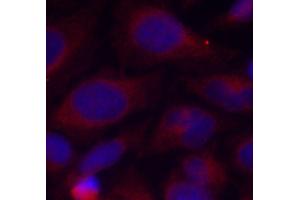 Immunofluorescence staining of methanol-fixed HeLa cells using Phospho-NFKB1-S893 antibody (ABIN2988205). (NFKB1 抗体  (pSer893))