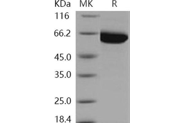 PAK3 Protein (PAK3) (His tag)