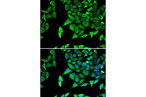 Immunofluorescence analysis of U2OS cells using NPPA antibody. (NPPA 抗体)