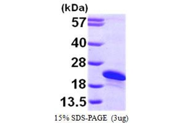 ARL2BP Protein (AA 1-163) (His tag)