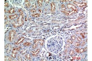 Immunohistochemistry (IHC) analysis of paraffin-embedded Human Kidney, antibody was diluted at 1:200. (CD56 抗体)