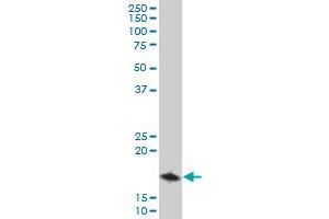 TOMM22 polyclonal antibody (A01), Lot # 051206JC01 Western Blot analysis of TOMM22 expression in A-431 . (TOMM22 抗体  (AA 1-142))