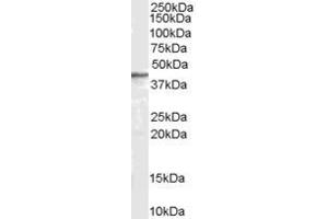 Western Blotting (WB) image for anti-Arrestin, beta 2 (ARRB2) (Internal Region) antibody (ABIN185395)