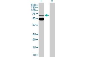 Western Blot analysis of MEF2C expression in transfected 293T cell line by MEF2C MaxPab polyclonal antibody. (MEF2C 抗体  (AA 1-469))