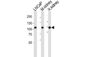 Western blot analysis of lysates from LNCaP cell line, mouse kidney, rat kidney tissue lysate(from left to right), using E Antibody (Center) (ABIN6243088 and ABIN6577473). (MME 抗体  (AA 492-525))
