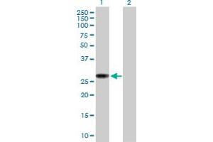 Western Blot analysis of NAT9 expression in transfected 293T cell line by NAT9 MaxPab polyclonal antibody. (NAT9 抗体  (AA 1-207))