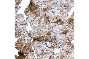 Immunohistochemistry (IHC) image for anti-Caspase 8 (CASP8) (AA 1-479) antibody (ABIN6137970)